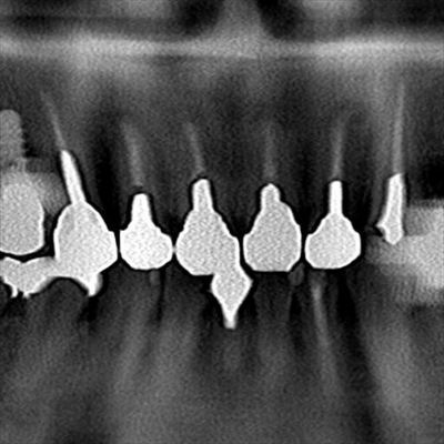 CT_20170105230555_R23.jpg
