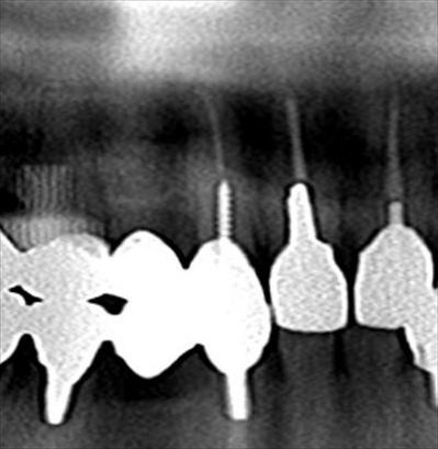 CT_20170112223409_R23.jpg