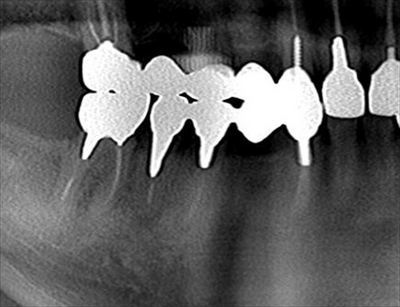 CT_20170207215706_R23.jpg