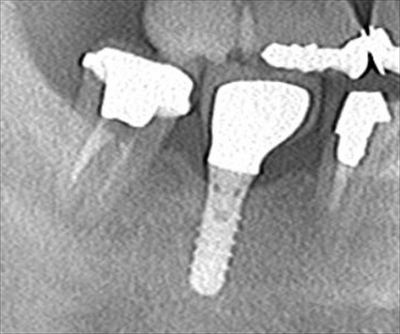 CT_20170220121949_R23.jpg