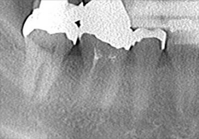 CT_20170225224800_R23.jpg