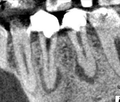 CT_20170308204501_R23.jpg