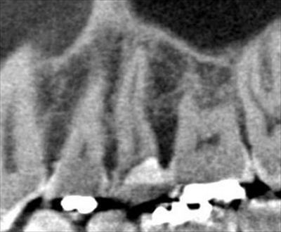 CT_20170309192701_R23.jpg