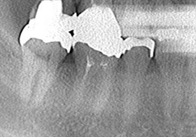 CT_20170311221433_R23.jpg