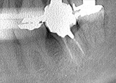 CT_20170311221704_R23.jpg