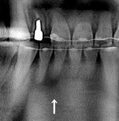 CT_20170318220413_R23.jpg