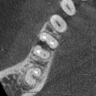 CT_20170323213830_R23.jpg