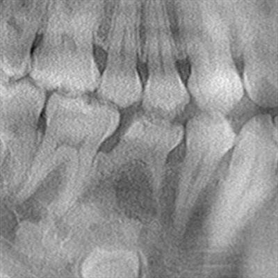 CT_320170301220219_R23.jpg