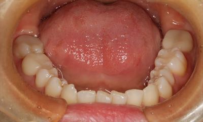 IMG_3615_R23.JPG