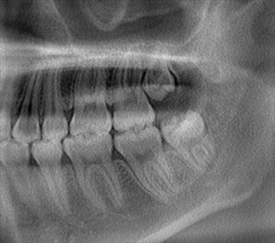 00f505_2015_04_17_CT_R24.jpg