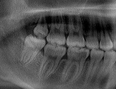 CT_20170902183322_R23.jpg
