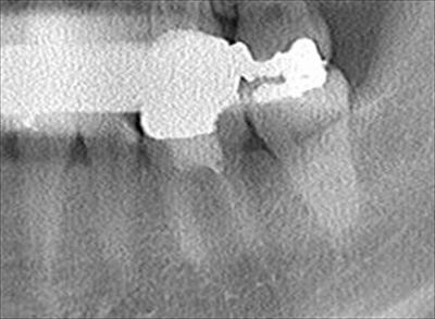 CT_20171025195758_R24.jpg
