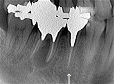 CT_20171110220346_R24.jpg
