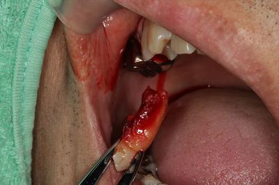 IMG_7778_R24.JPG