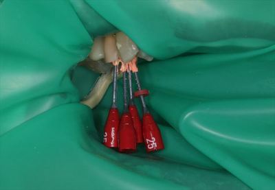 IMG_2969_R25.JPG