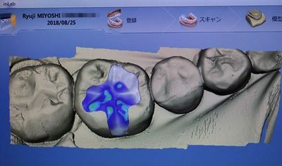 IMG_4979_R25.JPG