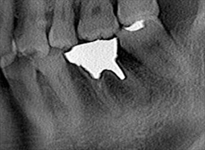 CT_20181002135920_R25.jpg