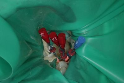 IMG_4449_R25.JPG