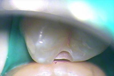 無題_0158.wmv_001193814_R25.jpg
