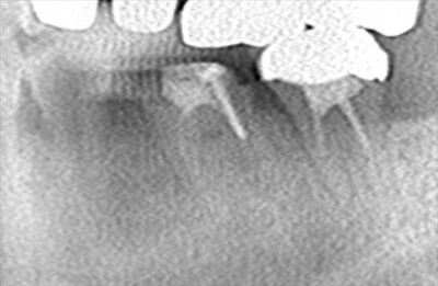 CT_20190202151833_R25.jpg