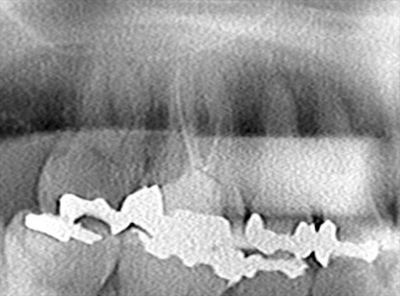 CT_20190211191558_R25.jpg