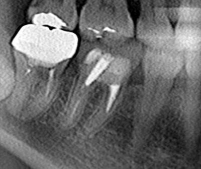 CT_2019021fd1191510_R25.jpg