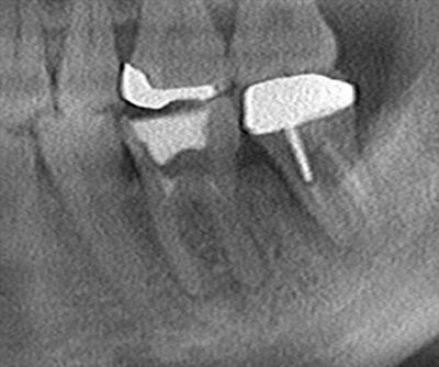 CT_20190314200311_R25.jpg