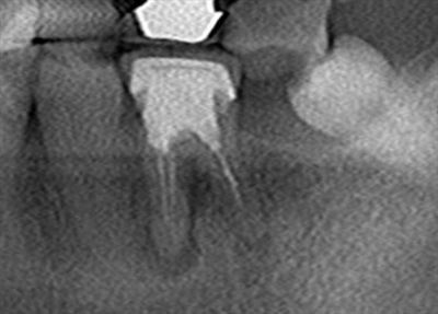 CT_20190406212512_R25.jpg