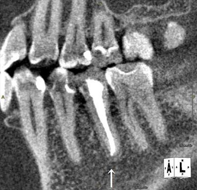 CT_20190427214353_R25.jpg