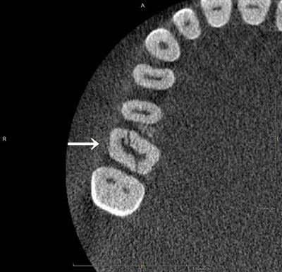 CT_20190618233523_R26.jpg