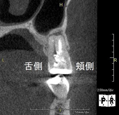 CT_20190706163724_R26.jpg