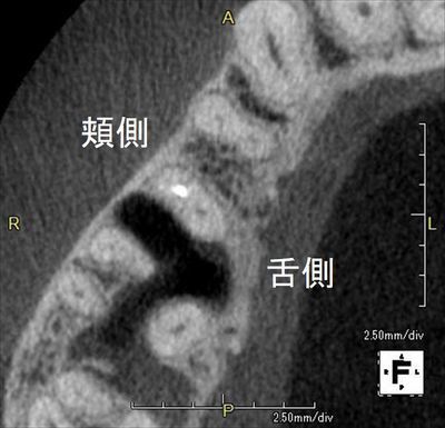 CT_20190706163730_R26.jpg