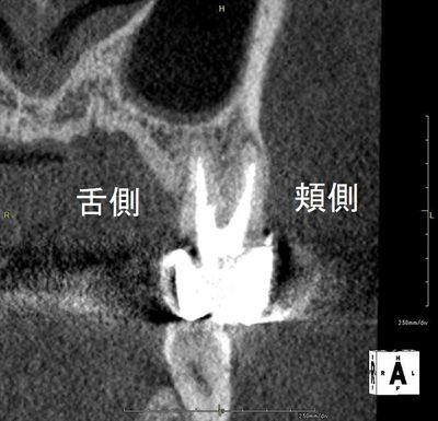 CT_20190709225952_R26.jpg