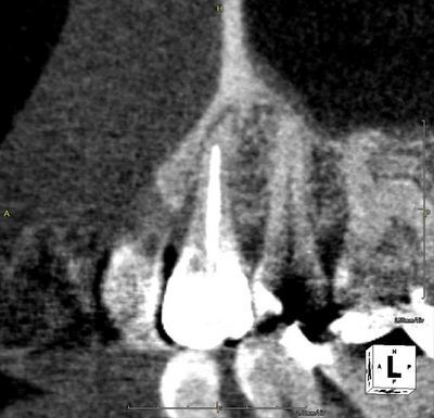 CT_20190709230001_R26.jpg