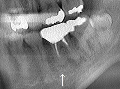 CT_20191005195741_R26.jpg