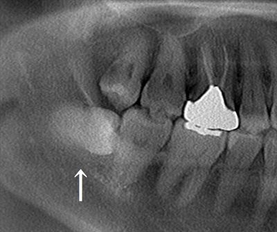 CT_20191013000853_R26.jpg