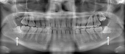 CT_20191026235240_R26.jpg