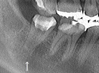 CT_20191102210542_R26.jpg