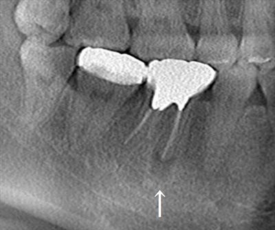 CT_20191114211706_R26.jpg