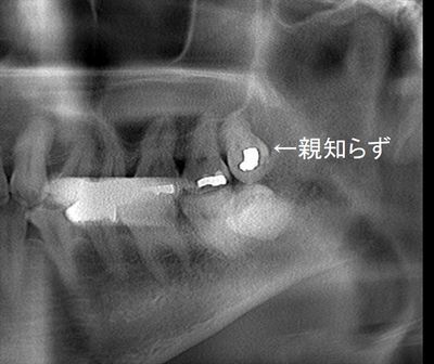 CT_20191125192231_R26.jpg