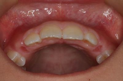 IMG_6875_R26.JPG