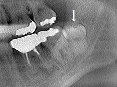CT_20191203212749_R26.jpg