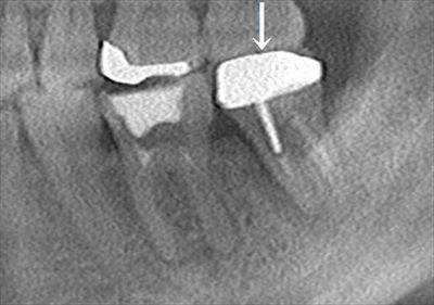 CT_20191219232626_R26.jpg
