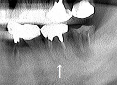 CT_20200121172657_R26.jpg