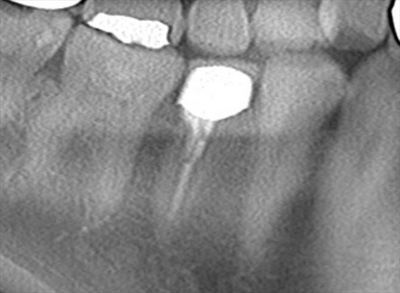CT_20200121172721_R26.jpg
